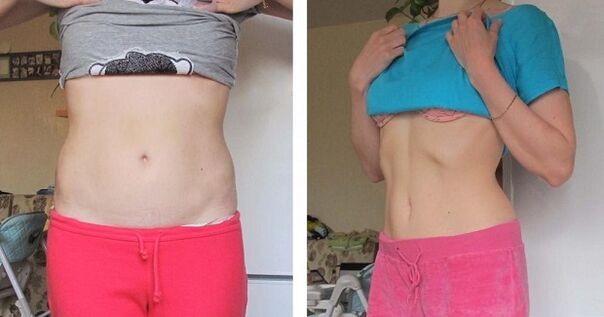 Before and after the Japanese diet